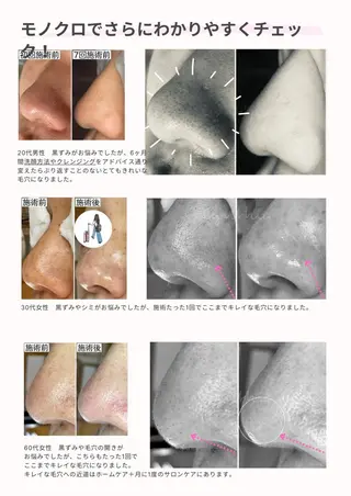 メンズ 毛穴ケア専門店 Cynthiaのエステ・リラクイメージ