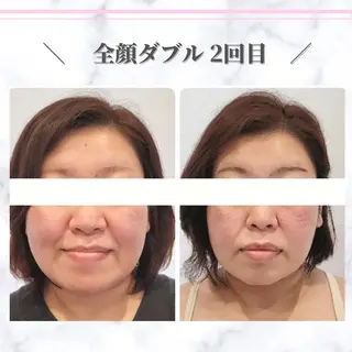 毛穴専門サロン ルシェリアのエステ・リラクイメージ