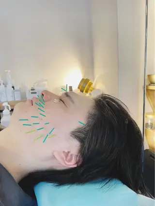 メンズ 小顔美容鍼専門サロン 渋谷YZのエステ・リラクイメージ