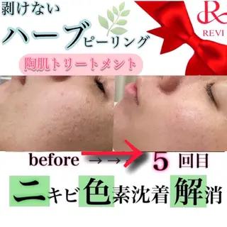 laluna saki...のその他イメージ