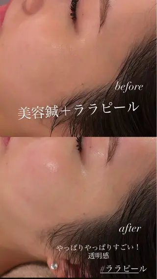 美容鍼灸サロン mahoroba院長のエステ・リラクイメージ