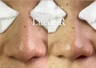 大久保 里奈のエステ・リラクイメージ