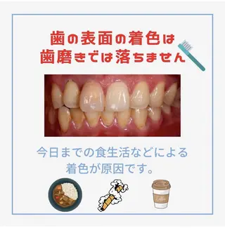 メンズ ホワイトニング ショップ船橋店のエステ・リラクイメージ