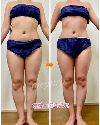 ショート カラー パーマ ヘアアレンジ メンズ キッズ ネイル マツエク・マツパ 痩身&ボディ 結果出し🌟丹野のエステ・リラクイメージ