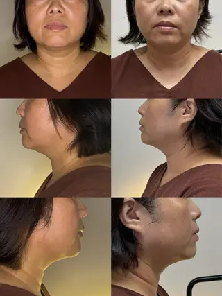 藤本 かいくのエステ・リラクイメージ