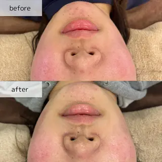 Venus所属・エステサロン Venusのエステ・リラクイメージ
