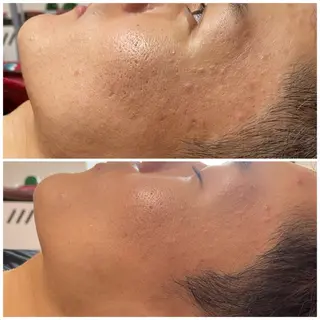 毛穴レス ハーブ＆ ワックス脱毛×光脱毛のエステ・リラクイメージ