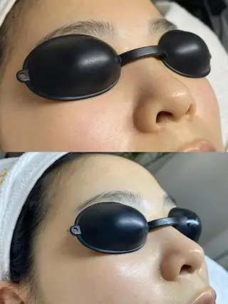 マツエク・マツパ aliaハイフ&水光ジェットサロン所属・aliaハーブ水光店 エステティシャン募集のエステ・リラクイメージ