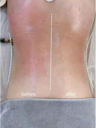 韓国式肌管理@毛穴洗浄 THE ONE 栄店所属・THEONE 山本のエステ・リラクイメージ