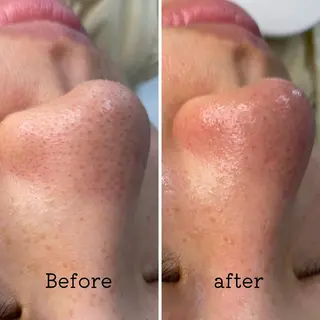 É LINDA所属・E LINDAのネイルデザイン