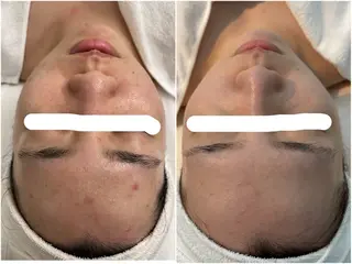 デ・アイム心斎橋所属・肌質改善サロン🫧 MAIのエステ・リラクイメージ