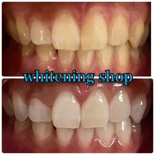 メンズ ホワイトニング ショップ川越店のエステ・リラクイメージ