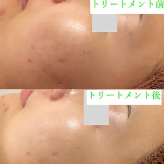 サロンドゥ ルシエルのエステ・リラクイメージ