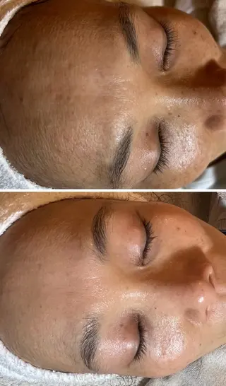 esty hitomiのエステ・リラクイメージ