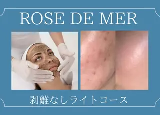 BestBelleꕤ 大阪福島/肌質改善のエステ・リラクイメージ