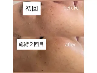 salon＿drop所属・salon dropのエステ・リラクイメージ