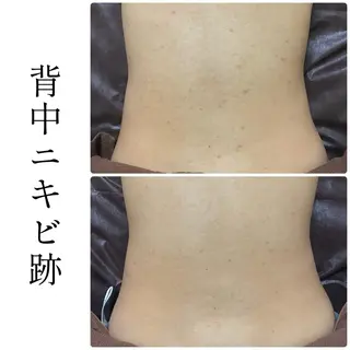 ハーブピーリング専門 BIOEL横浜のエステ・リラクイメージ