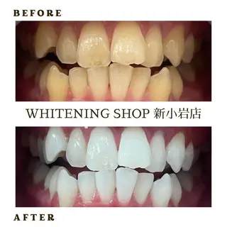 メンズ ホワイトニング ショップ新小岩店のその他イメージ