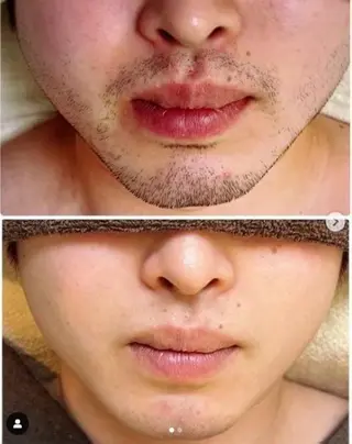 メンズ アルカンジュ~archange~所属・痩身/毛穴洗浄/脱毛 アルカンジュのエステ・リラクイメージ