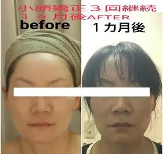 小顔と美肌 まごころエステMatoria所属・小顔 美肌専門 Matoriaのエステ・リラクイメージ