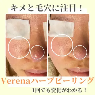 ピーリング専門店 Belluteのエステ・リラクイメージ