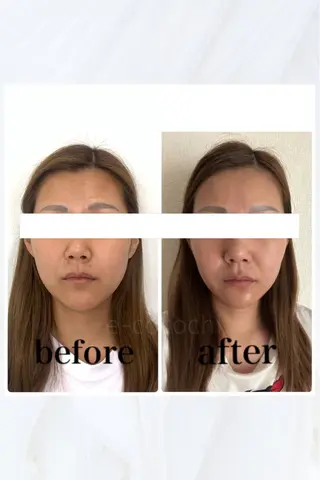 小顔と ヘッドスパのお店のエステ・リラクイメージ