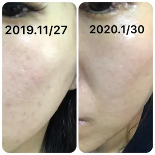 【足圧】鬼👹リンパ 身体整うサロンのエステ・リラクイメージ