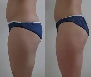 ホワイティアビシェル ウラワ 白澤奇のエステ・リラクイメージ