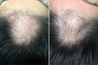 セントラル鍼灸院 Re:laxyのエステ・リラクイメージ