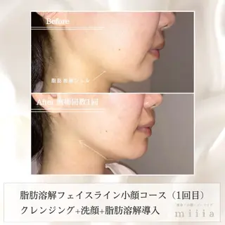 森近 美優のエステ・リラクイメージ