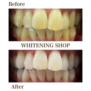 ホワイトニング ショップ川越店のエステ・リラクイメージ