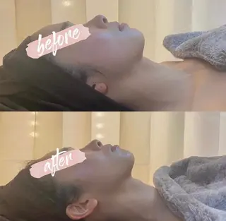 BELCIA福岡店　récolte de BELCIA（レコルトデベルシア）所属・BELCIA福岡店 レコルトデベルシアのエステ・リラクイメージ