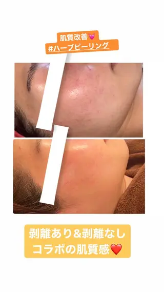 FLEUR大阪・整体 ・ハイフ・痩身・小顔のエステ・リラクイメージ