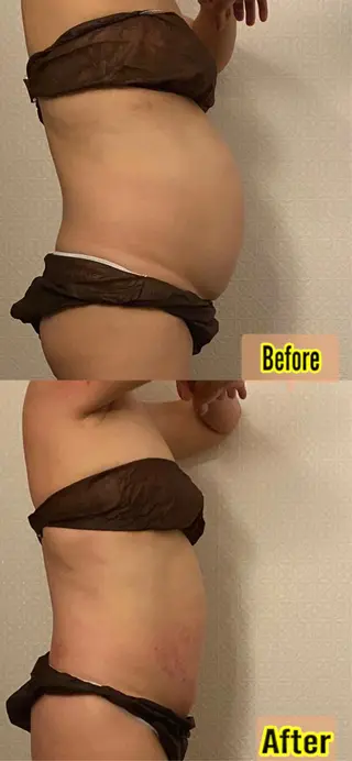 所沢痩身小顔コルギ AromaQueenのエステ・リラクイメージ