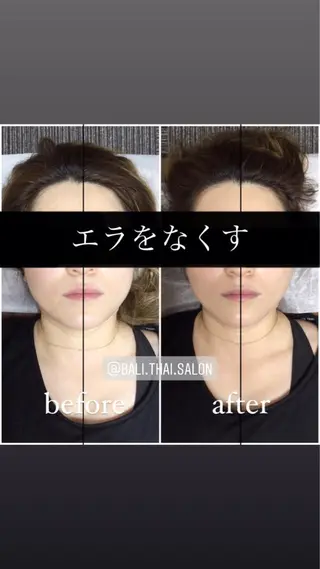 🌈歪み改善🌈 バリンタイ すぎうらのエステ・リラクイメージ