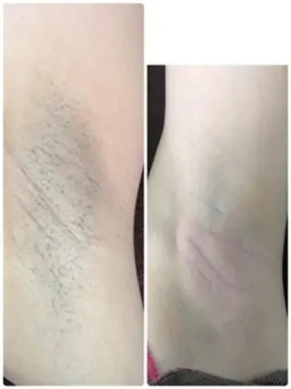 Lien オーナー 山口智嘉のエステ・リラクイメージ