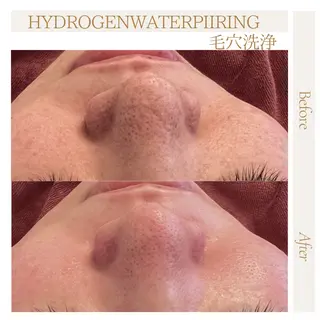 肌管理サロン neoriiのその他イメージ