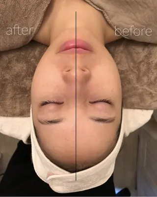 ✨美肌水光✨ アトリエリュバンのエステ・リラクイメージ