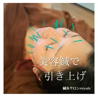 鍼灸サロンmiyabi所属・美容鍼×エステ　鍼灸 サロンmiyabiのエステ・リラクイメージ