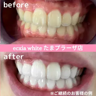 セルフホワイトニング　エクシアたまプラーザ店所属・セルフホワイトニング エクシアたまプラーザのその他イメージ