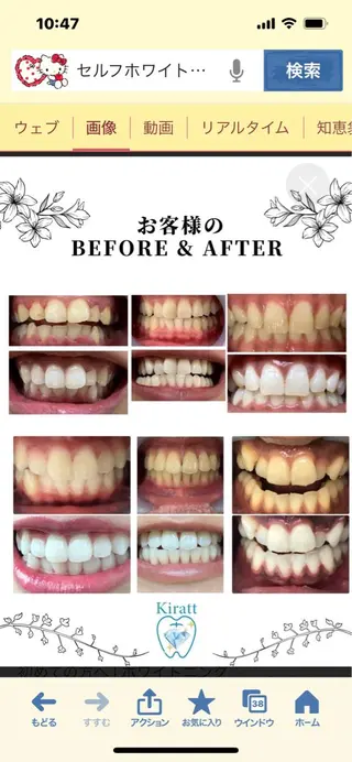 WHITENING ハウスのマツエク・マツパデザイン