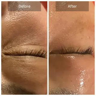 Mandarin Orange所属・毛穴から始める肌メン テマンダリンオレンジのエステ・リラクイメージ