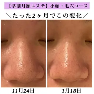 Bellesthe (ベルエステ)のエステ・リラクイメージ