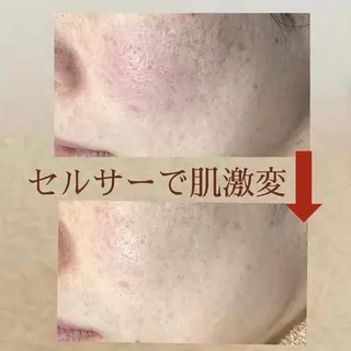 都度払い 肌質改善専門サロンのエステ・リラクイメージ