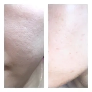 【足圧】鬼👹リンパ 身体整うサロンのエステ・リラクイメージ