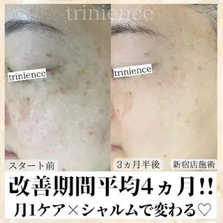 シミケア・肌改善専門 トリニエンス浦和店のエステ・リラクイメージ
