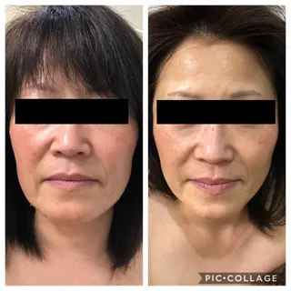 BeautySalonGemmy所属・Gemmy 愛美のエステ・リラクイメージ