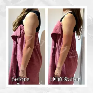 部分痩せ♥️小顔専門 MIKUのエステ・リラクイメージ