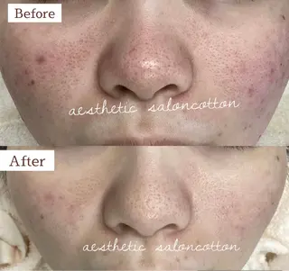 都度払い 肌質改善専門サロンのエステ・リラクイメージ