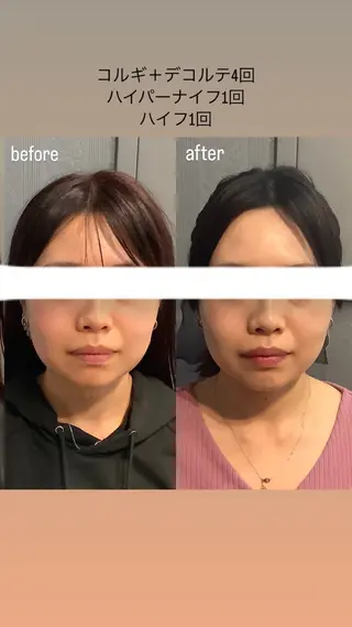 エステサロンino.colore'所属・小顔サロン ino.coloreのエステ・リラクイメージ